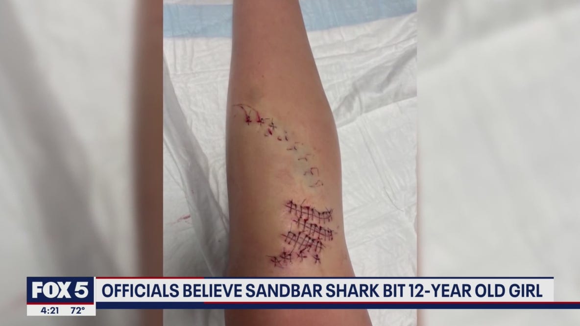 Ocean City shark bite confirmed say Beach Patrol officials