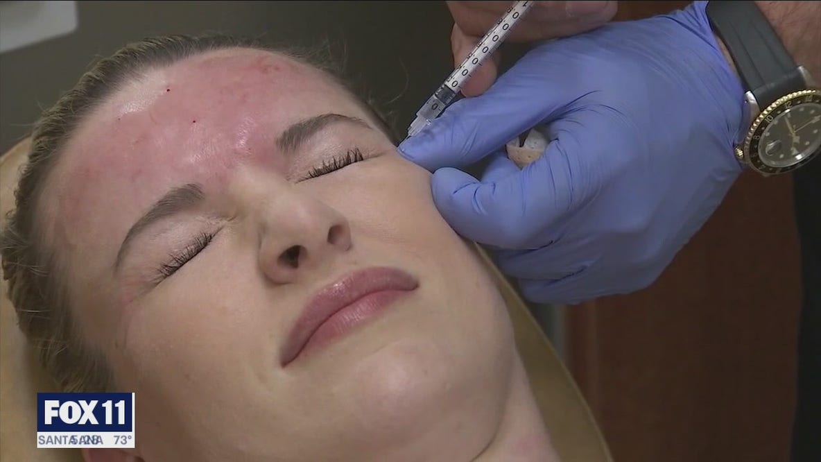 COVID-19 vaccine could cause reactions for those with facial fillers