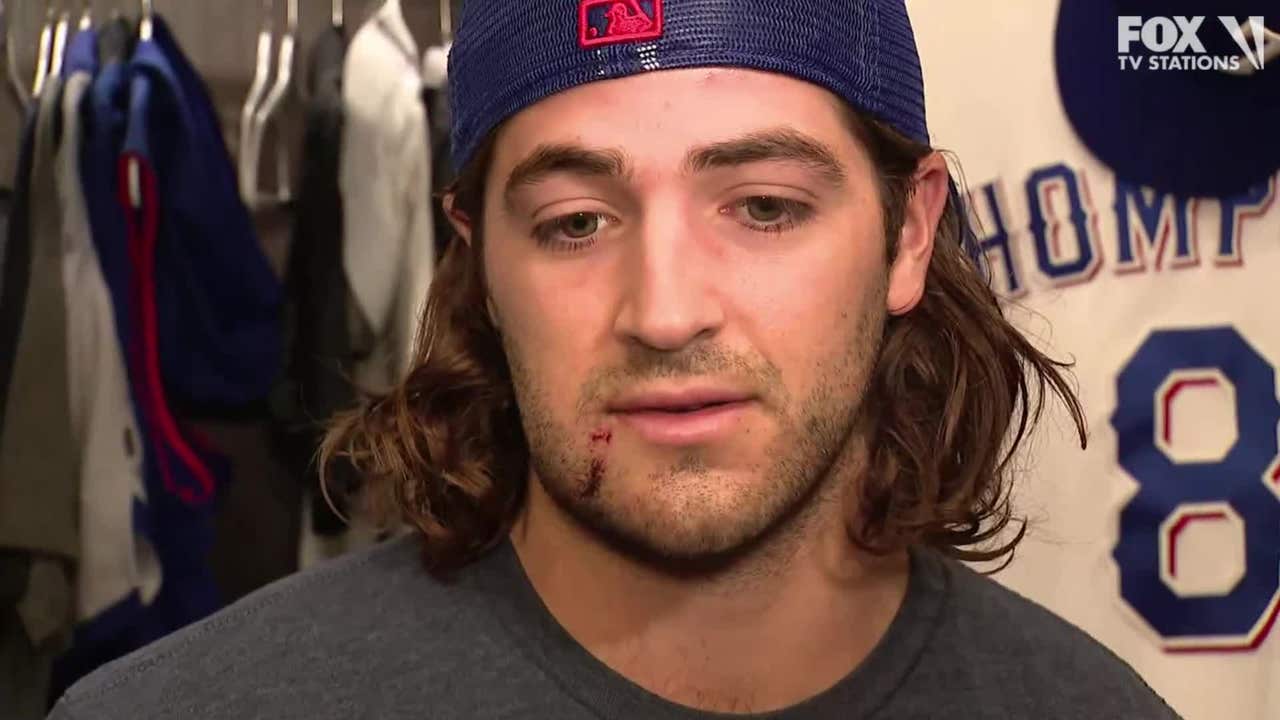 Josh Smith Talks About Getting Hit In The Face With A Pitch FOX 4 josh-smith-talks-about-getting-hit-in-the-face-with-a-pitch-fox-4