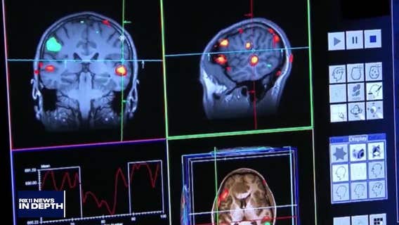 In Depth: Aphasia, sideshows, student loans