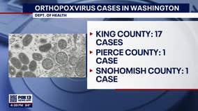 DOH: 20 people in Washington likely have monkeypox