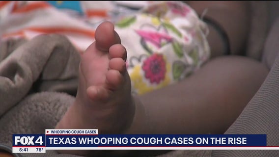 Whooping cough cases on the rise in Texas