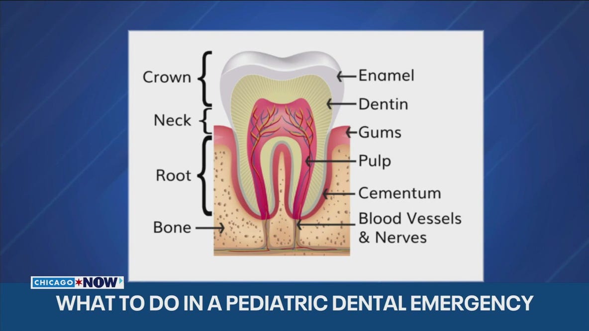 Pediatric dentists shares tips for handling holiday dental emergencies | ChicagoNOW