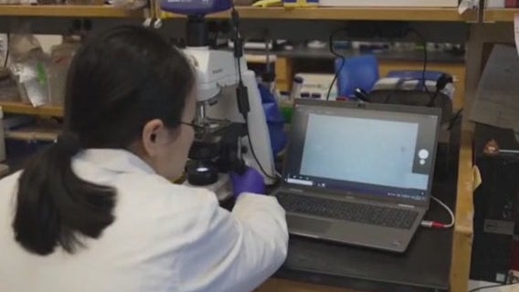 Gut microbiome tests: Experts issue warning