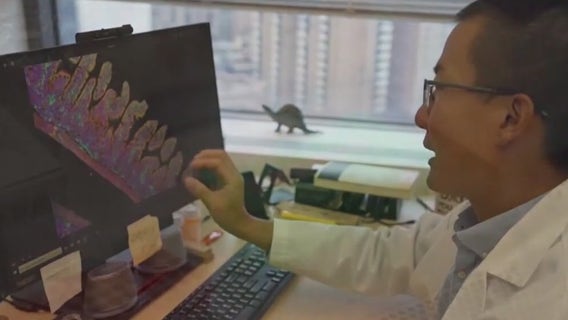 Psychiatric conditions and Alzheimer's