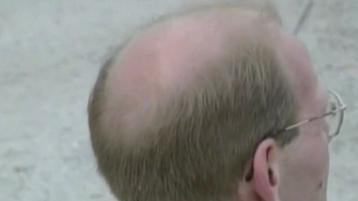 Cure for balding could be in your kitchen