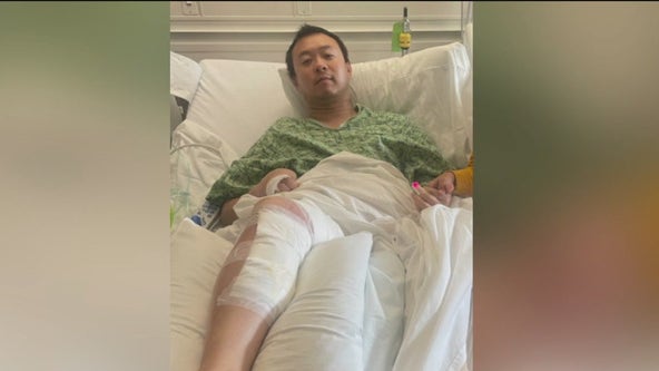 Oakland Juneteenth shooting victim may lose use of left leg
