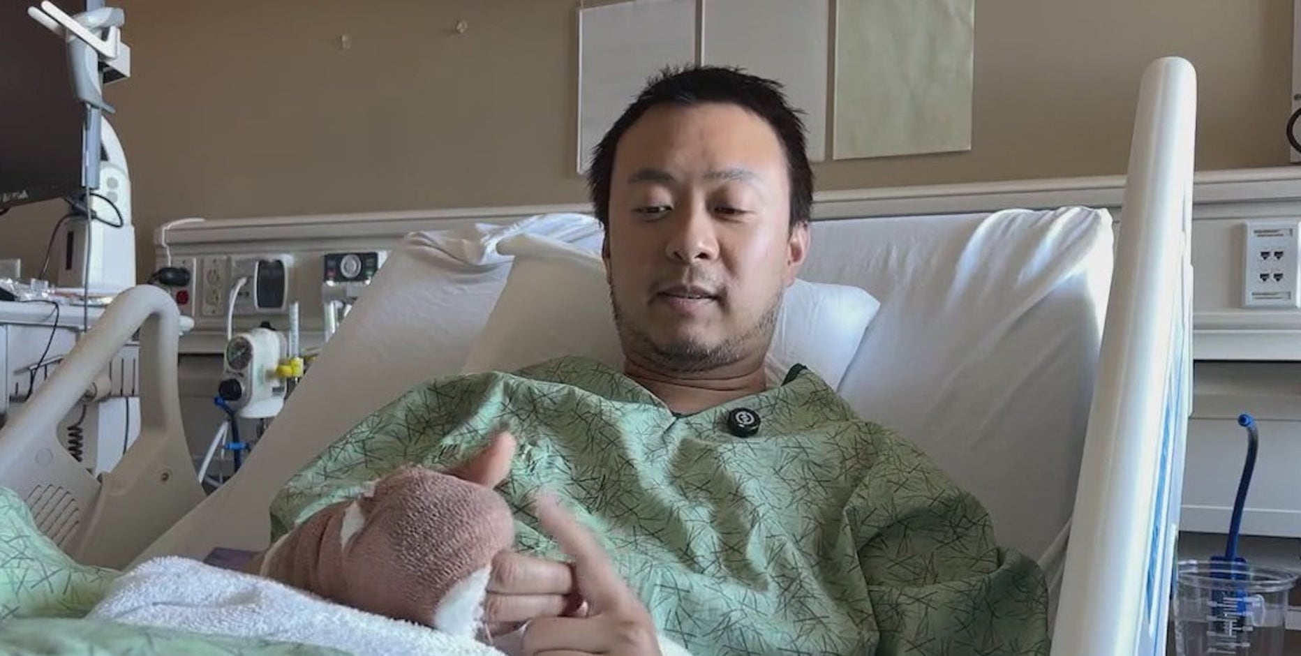 Juneteenth mass shooting victim fights against leg amputation, bullets still lodged inside