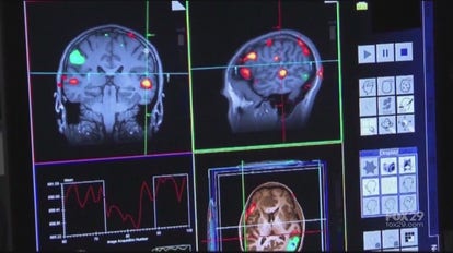 Working to find a cure for Alzheimer's Disease | FOX 29 News Special