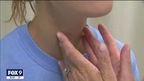 Twin Cities seeing surge in strep throat