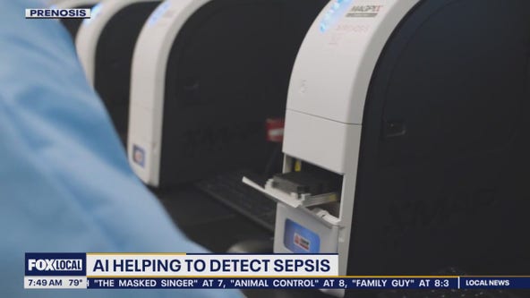 AI helping to detect sepsis