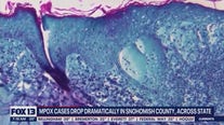 Monkeypox cases drop dramatically across Washington state