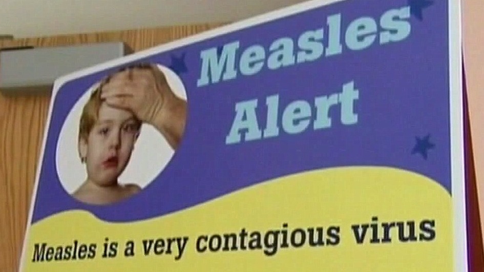 3 cases of measles confirmed in Michigan