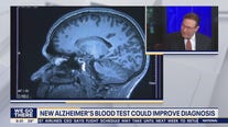 Health Watch: New Alzheimer's blood test could improve diagnosis