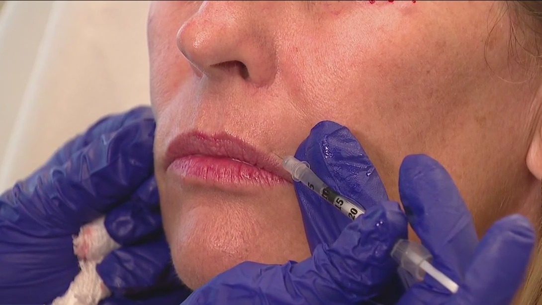Why more parents are turning to Botox
