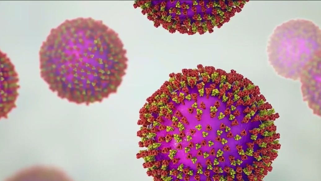 Chicago faces measles surge: Total cases surpass 50
