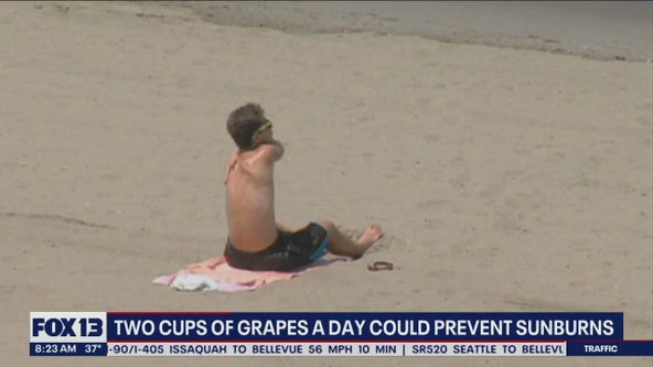 Two cups of grapes a day could prevent sunburns