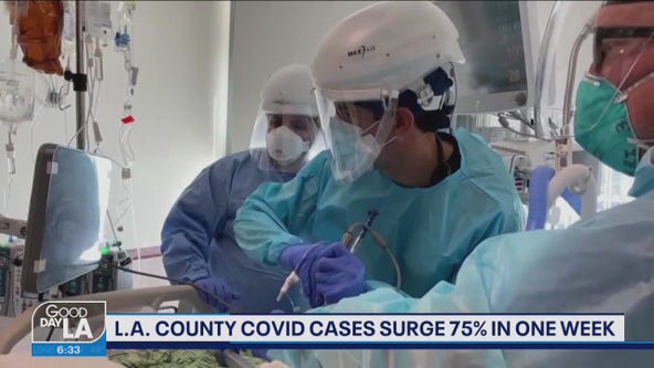 LA County cases up by 75% in one week