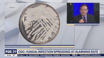 Health Watch: CDC warning of fungal infection spreading at 'alarming rate'