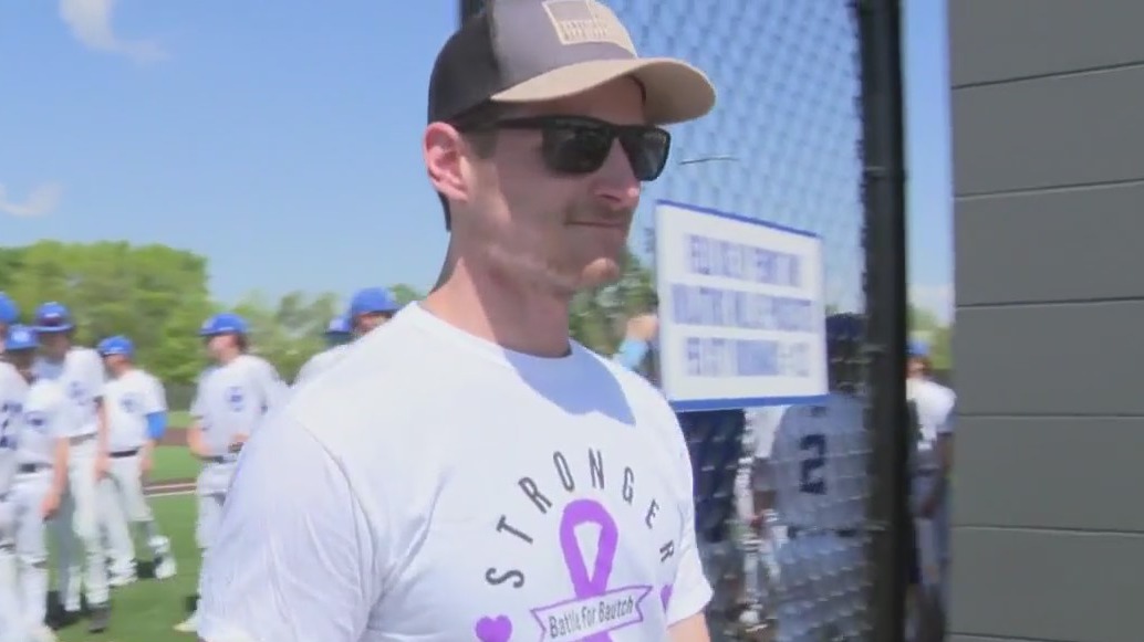 Charity game, cancer survivor recognized