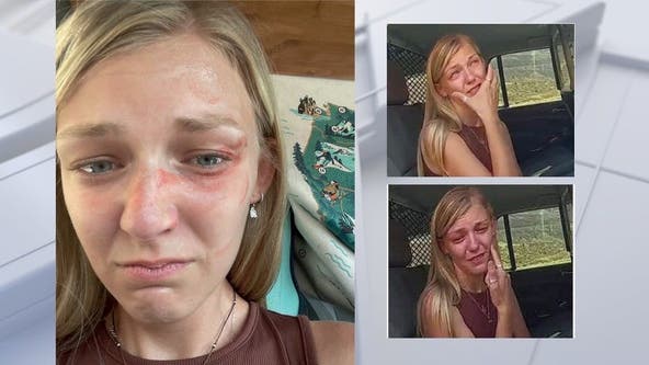 Gabby Petito selfie shows bruises on her face, photo taken same say of Utah traffic stop