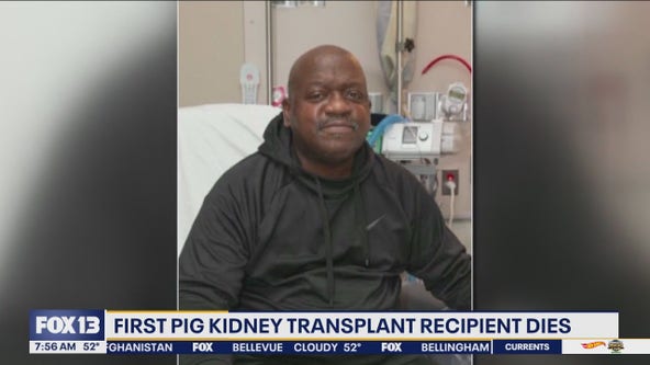 1st pig kidney transplant recipient dies