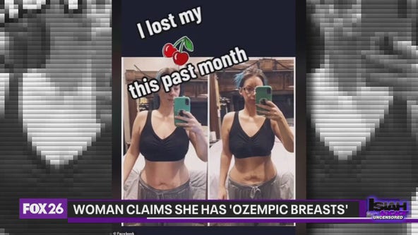 Woman claims 'Ozempic breasts' as side effect of drug