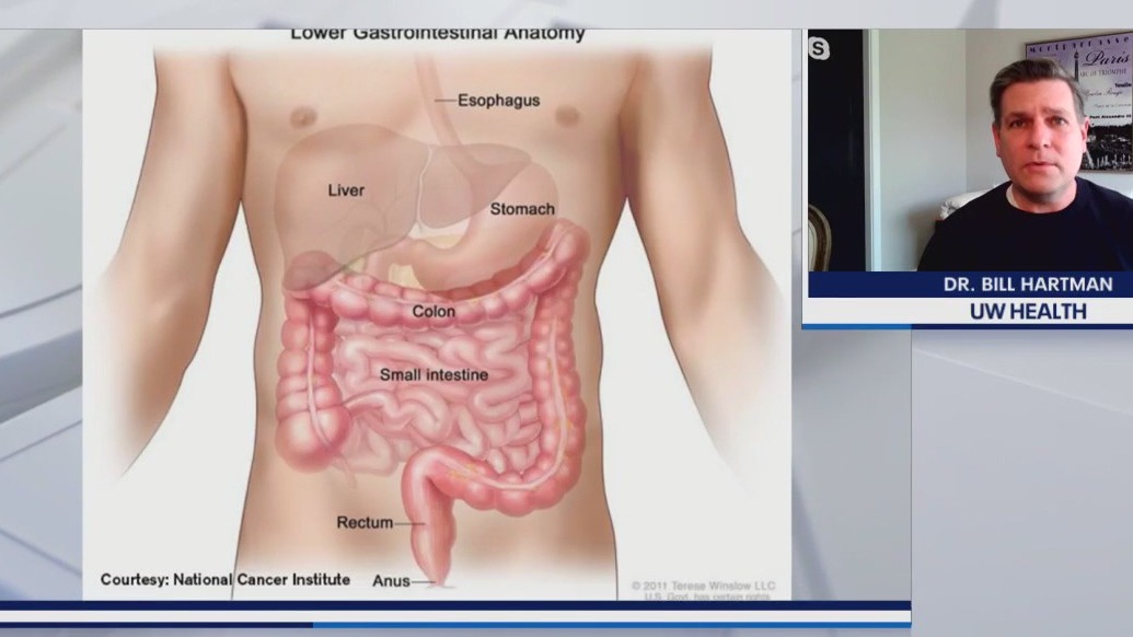 Expert discusses colon cancer and how it affects the youth