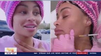 Blac Chyna gets filler removed