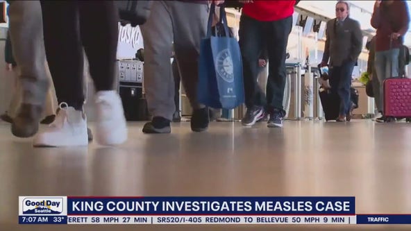 King County investigates first measles case