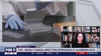 CDC: Deadly fungal infection Candida auris spreading at alarming rate