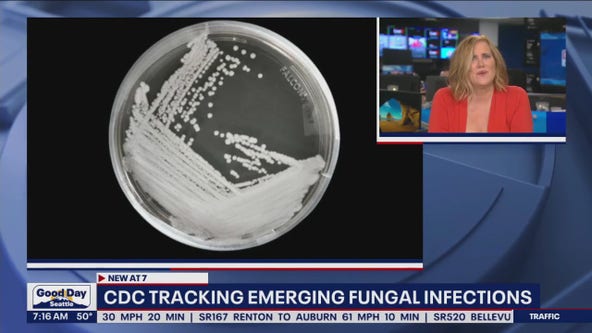 CDC tracking emerging fungal infections