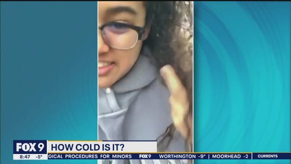 New Minnesotan's hair freezes in the cold