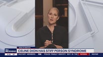 What is Stiff Person Syndrome? A neuroimmunologist breaks down the disease affecting Celine Dion