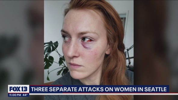 3 women were attacked in three separate instances in two days in Seattle