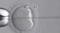 AL court ruling on embryos leaves some worried