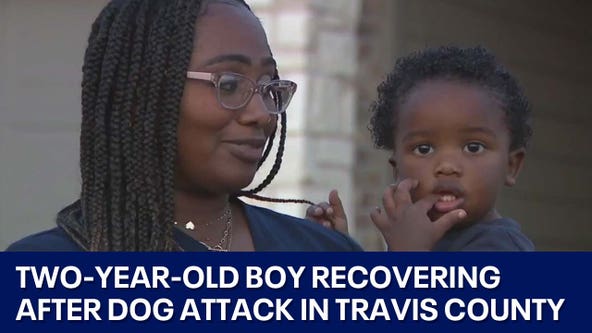 Boy recovering after dog attack in Travis Co.