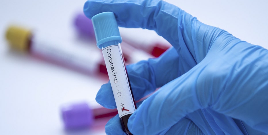 Coronavirus cases in Arizona surpass 100,000; 1,810 deaths reported