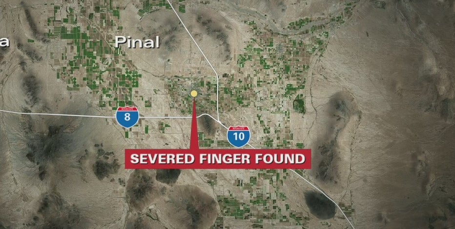 Arizona man accused of slashing neighbor's tires; left his severed finger behind