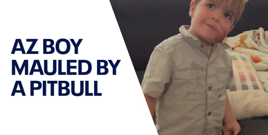 Arizona mom speaks out after young son was mauled by pitbull