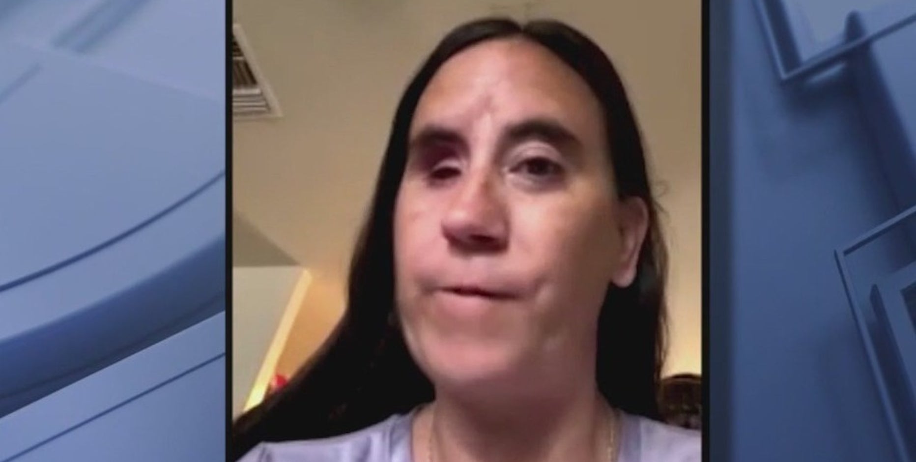 Arizona woman loses an eye after being shot during a break-in, attempted sexual assault