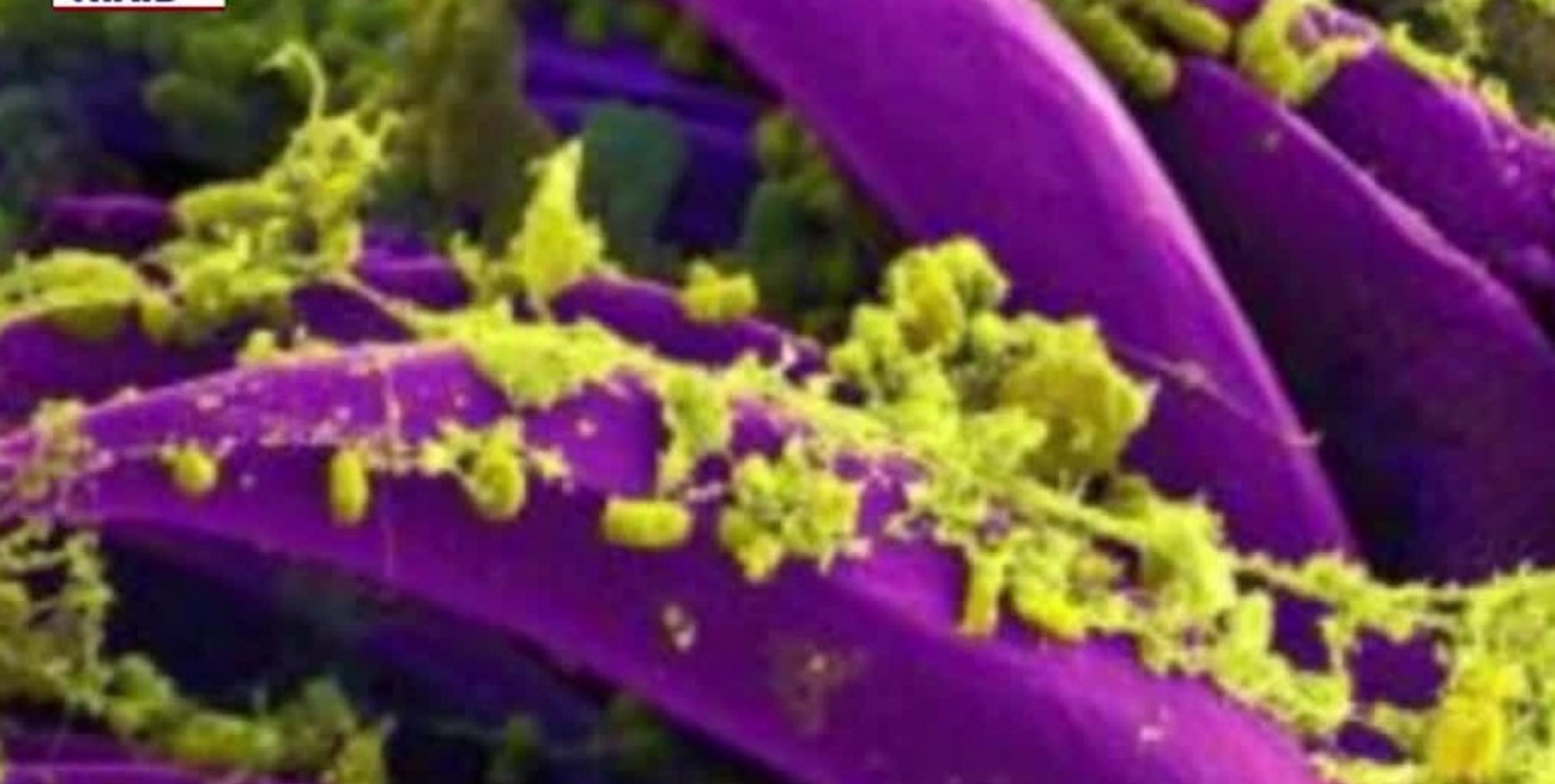 Plague in Arizona: Health officials address concerns after Flagstaff death