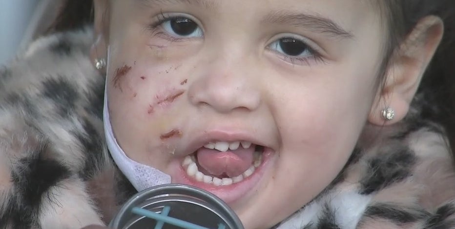 3-year-old girl recovering after being mauled by dog in Spring