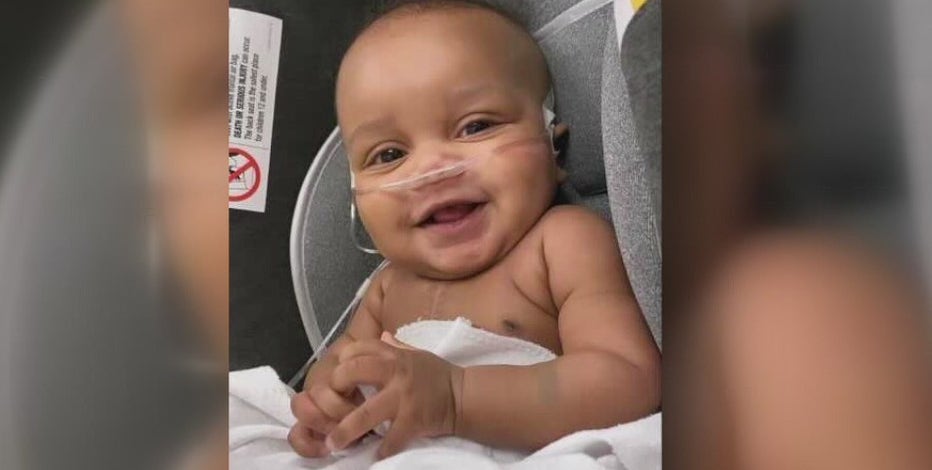 Houston doctors help save baby with unusual heart defect from Mississippi