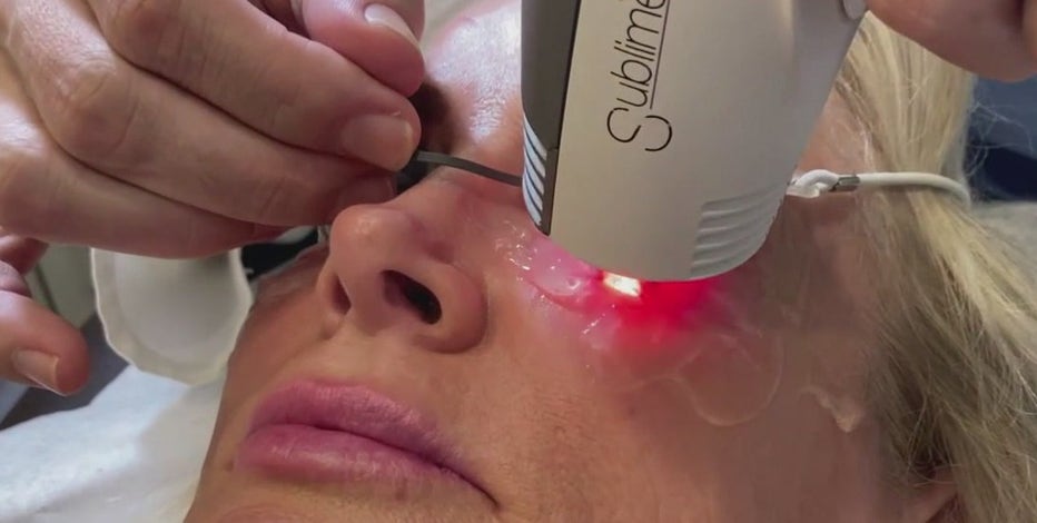New treatment for dry eyes also zaps wrinkles