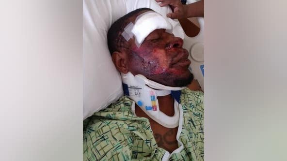 Family members demand answers after Black man was tased by HCSO, said to be on his deathbed