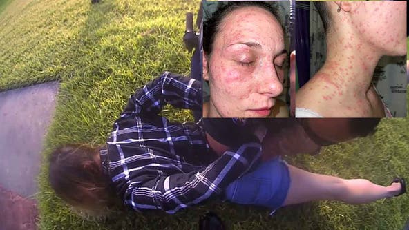 Galveston County woman suing, claims Santa Fe officer's held her face in fire ants