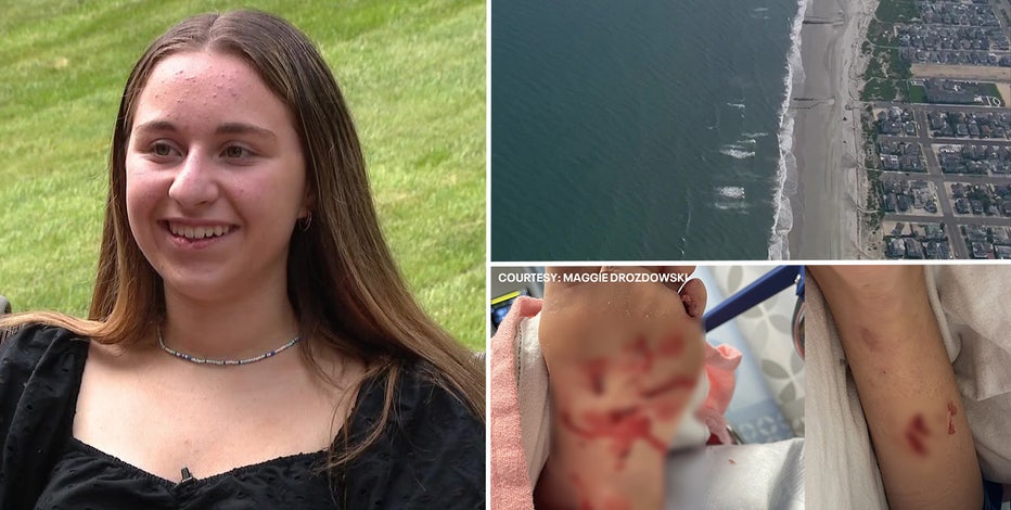 Teen surfer recalls shark attack off New Jersey coast: 'It pulled me down a little bit'