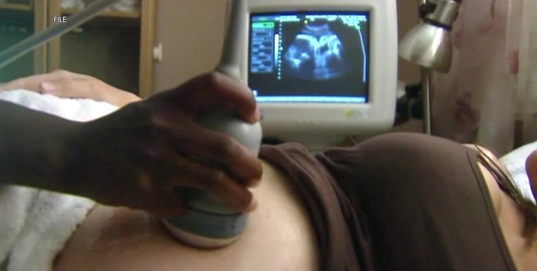 Improving maternal mortality rates is goal as health officials, city leaders seek solutions