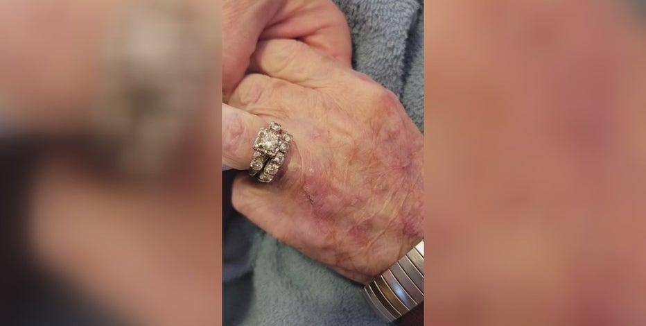 Wedding ring disappears from 92-year-old woman's hand at Monroe nursing home